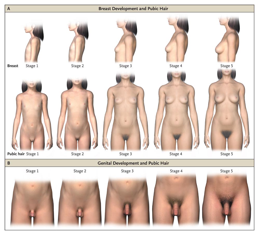 Nude Stages Of Puberty Growth