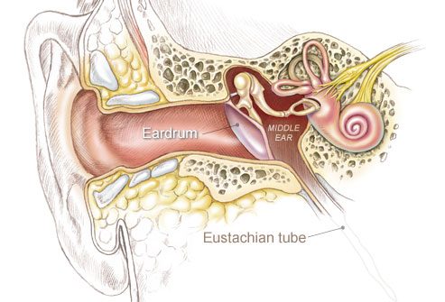 middle ear infection