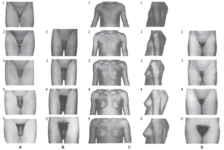 Chart of photos of boy's various physical changes at the tanner stages...